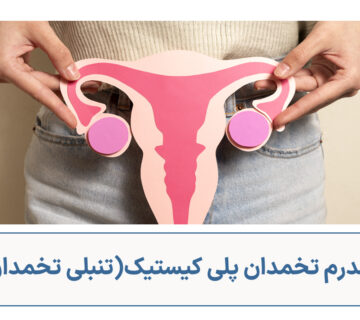 سندرم پلی کیستیک(تنبلی تخمدان) چیست؟