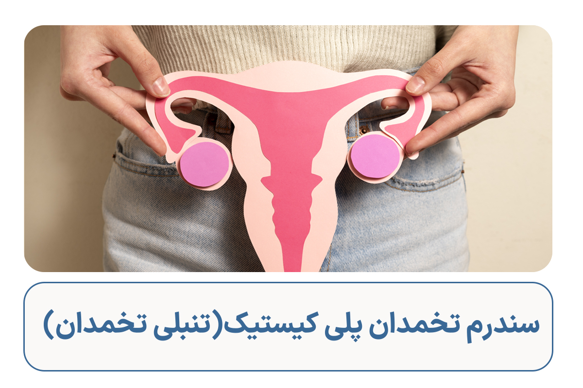 سندرم پلی کیستیک(تنبلی تخمدان) چیست؟